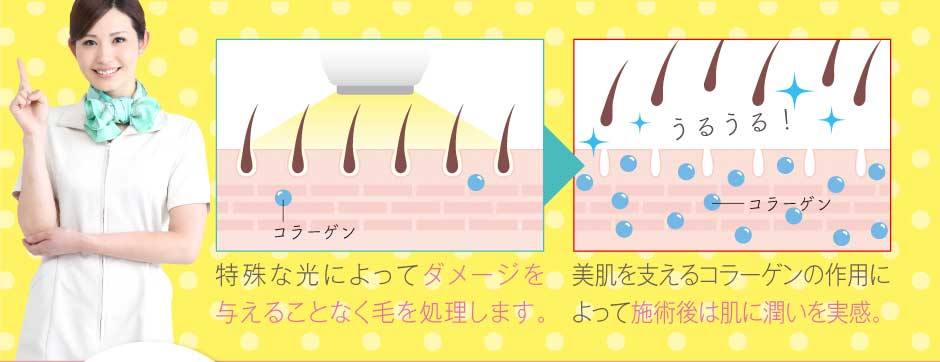 特殊な光によってダメージを与えることなく毛を処理します。美肌を支えるコラーゲンの作用によって施術後は肌に潤いを実感。