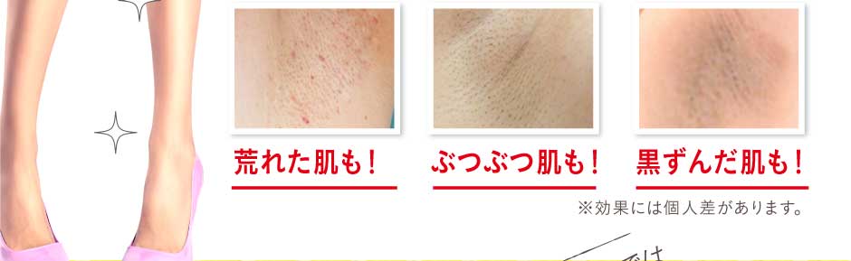 黒ずんだ肌も！ぶつぶつ肌も！荒れた肌も！360度お肌にハリ・ツヤを実感！