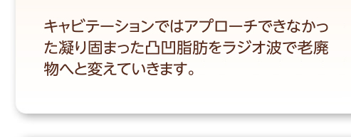 キャビテーションではアプローチできなかった凝り固まった凸凹脂肪をラジオ波でアプローチさせていきます。