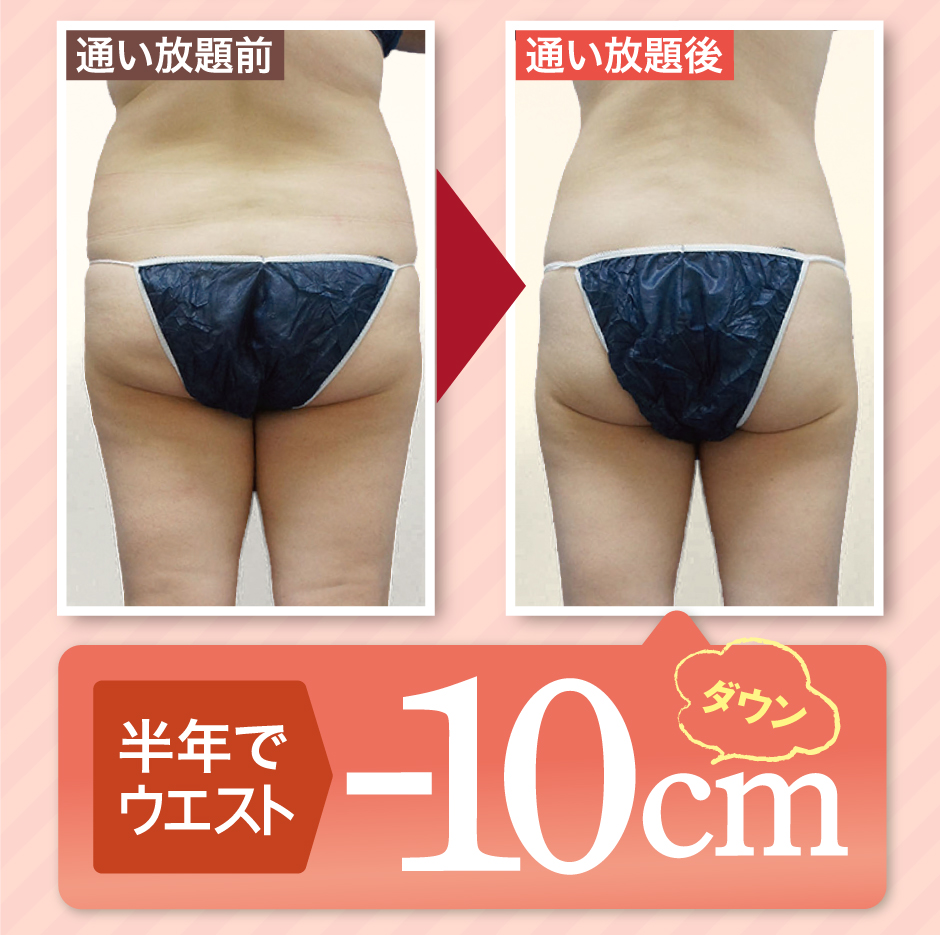 ふくらはぎ太もも お尻 お腹 腰肉 二の腕　二の腕から太ももまでできます！